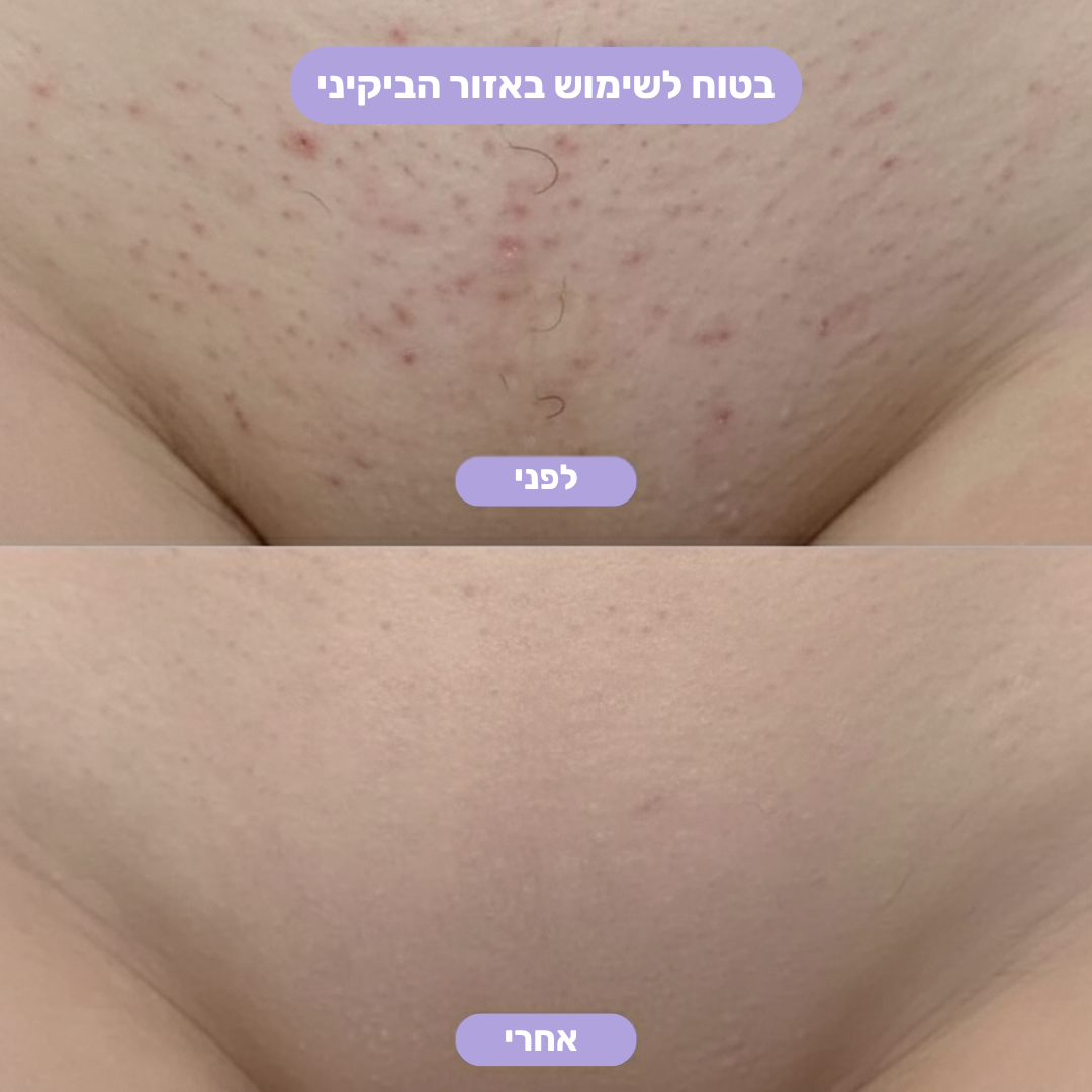 מחק השיער  של LADIVA