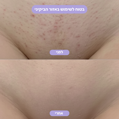 מחק השיער  של LADIVA