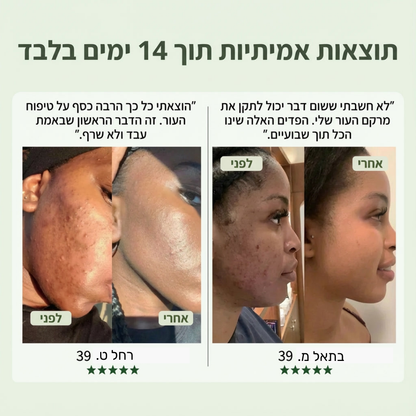 פדים לניקוי והברקת העור (Anti-Aging) קוריאניים
